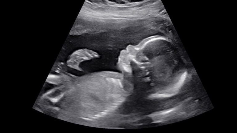 Second Trimester Pregnancy Update: Weeks 14-20