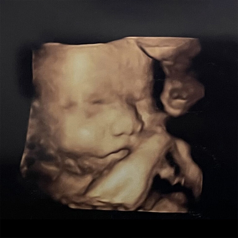 Second Trimester Pregnancy Update: Weeks 21-27